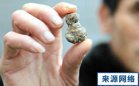 肾结石吃角瓜,角瓜助力健康排石新选择